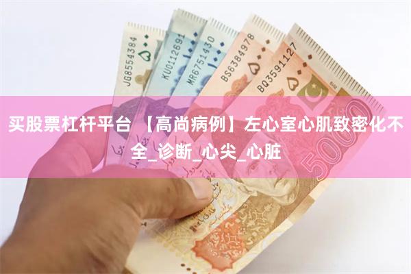 买股票杠杆平台 【高尚病例】左心室心肌致密化不全_诊断_心尖_心脏